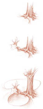 arbres-small